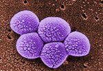 staph aureus, traditional treatments