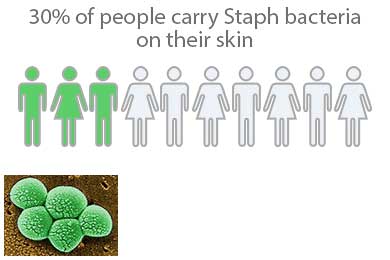30% of people carry Staph bacteria on their skin