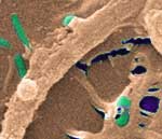 Bacteria resistance from biofilms