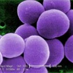 MRSA bacteria