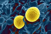 Staph aureus treatment