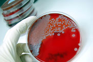 MRSA Staph growing on a culture test plate